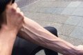Причины и варианты лечения болей и вздутия вен на руках